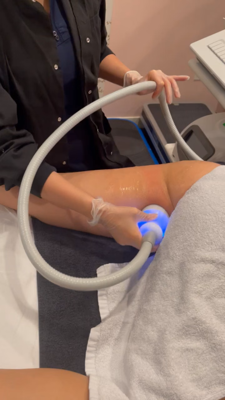 A gloved practitioner applies a body-contouring handpiece to an arm