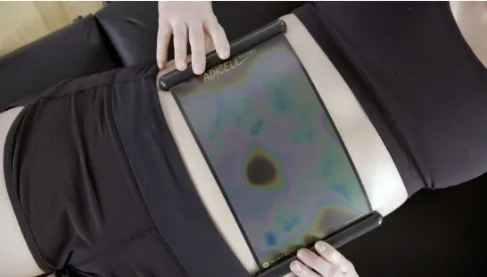 Body-contouring device held against a treatment area